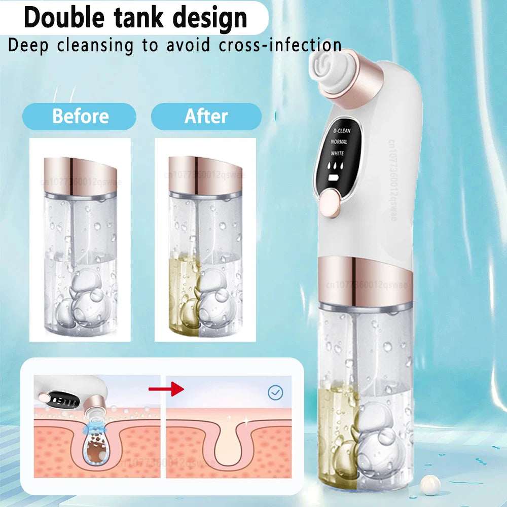 GLAZESKIN Pore Vacuum Blackhead Remover