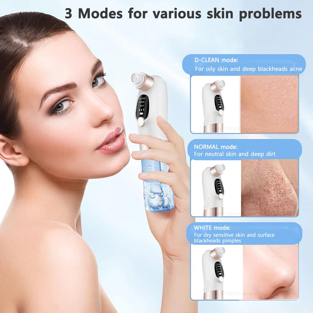 GLAZESKIN Pore Vacuum Blackhead Remover
