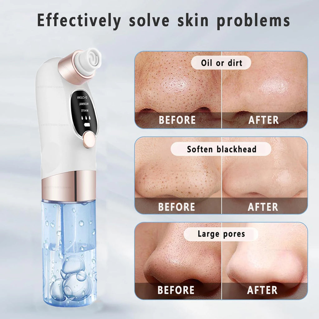 GLAZESKIN Pore Vacuum Blackhead Remover