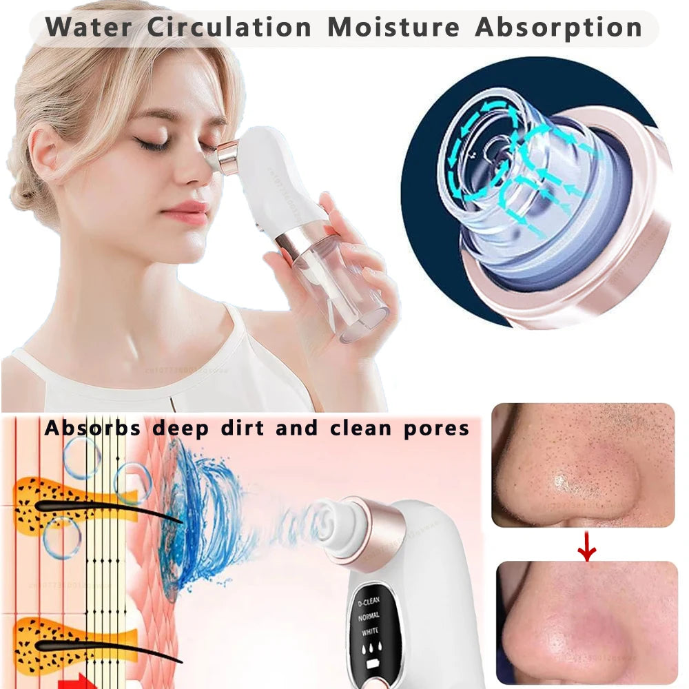 GLAZESKIN Pore Vacuum Blackhead Remover